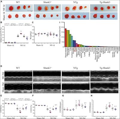 SHANK3 Co-ordinately Regulates Autophagy and Apoptosis in Myocardial Infarction